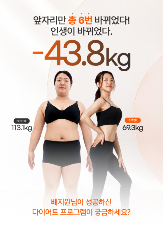 아트너주사 -43.8kg 성공스토리